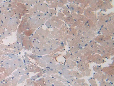 Heat Shock Protein Beta 6 (HSPb6) Monoclonal Antibody - image 4