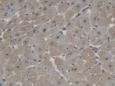 Brain Natriuretic Peptide (BNP) Polyclonal Antibody - image 3