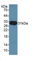 Aldolase A, Fructose Bisphosphate (ALDOA) Polyclonal Antibody - image 2