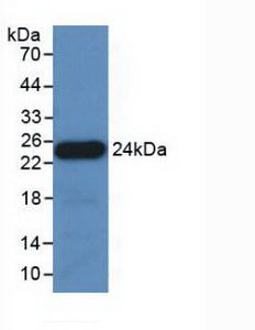 Western Blot; Sample: Lane1: Porcine Serum; Lane2: Porcine Lung lysate; Lane3: Porcine Cerebrum lysate; Primary Ab: 1µg/ml Rabbit Anti-Porcine APOE Antibody; Second Ab: 0.2µg/mL HRP-Linked Caprine Anti-Rabbit IgG Polyclonal Antibody;