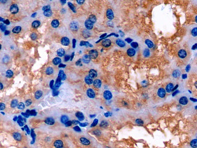 DAB staining on IHC-P; Samples: Porcine Liver Tissue;  Primary Ab: 20µg/ml Rabbit Anti-Porcine APOE