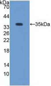 Protein Kinase C Beta 1 (PKCb1) Polyclonal Antibody - image 2