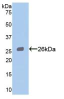 Signal Transducer And Activator Of Transcription 3 (STAT3) Polyclonal Antibody - image 2