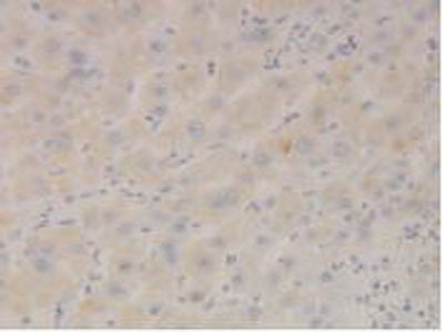 Figure. DAB staining on IHC-P; Samples: Human Stomach Tissue.