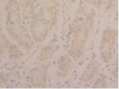 Signal Transducer And Activator Of Transcription 3 (STAT3) Polyclonal Antibody - image 4