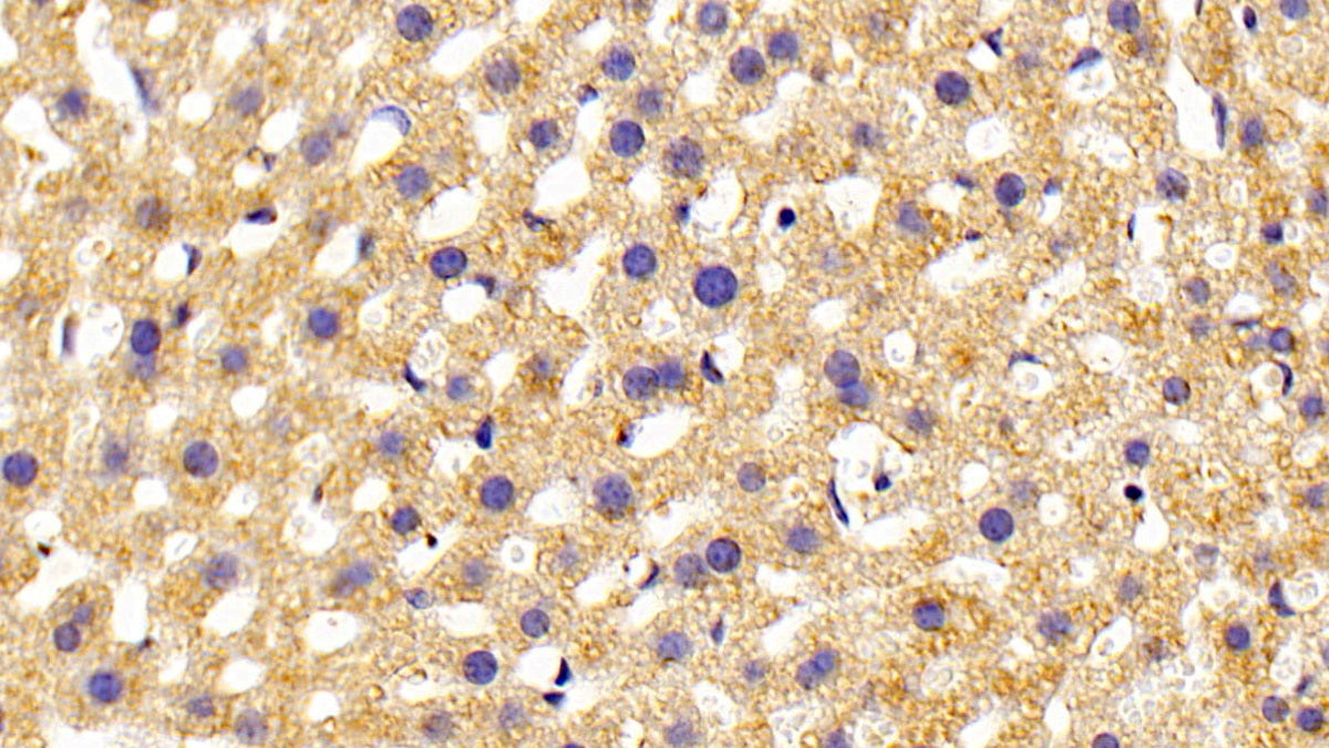 Phospholipase C Epsilon 1 (PLCe1) Polyclonal Antibody - image 3