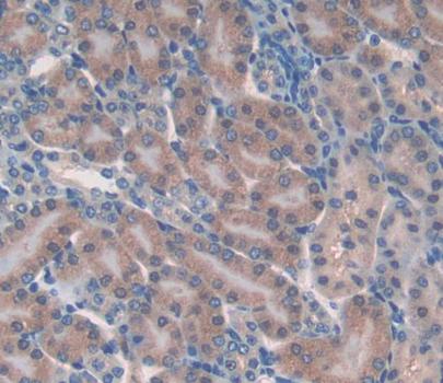 Glutathione Peroxidase 6, Olfactory (GPX6) Polyclonal Antibody - image 3