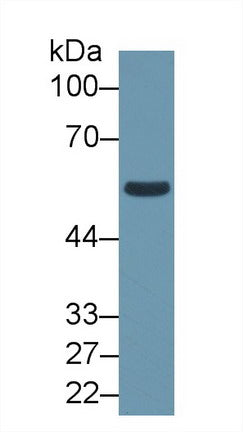 Aldehyde Dehydrogenase 1 Family, Member B1 (ALDH1B1) Polyclonal Antibody - image 2