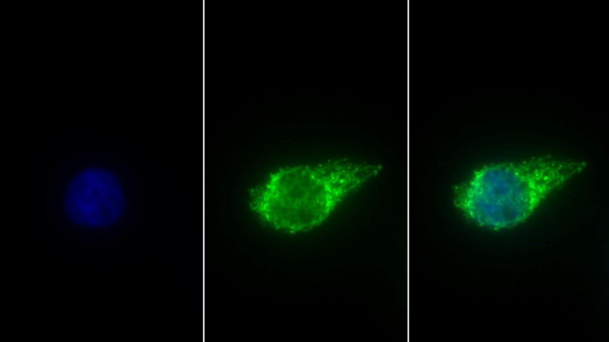 Aldehyde Dehydrogenase 1 Family, Member B1 (ALDH1B1) Polyclonal Antibody - image 3