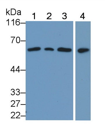 DAB staining on IHC-P; Samples: Human Kidney Tissue; Primary Ab: 20µg/ml Rabbit Anti-Human PTEN Antibody Second Ab: 2µg/mL HRP-Linked Caprine Anti-Rabbit IgG Polyclonal Antibody