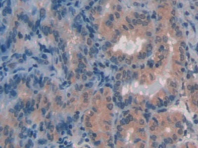 Phosphatase And Tensin Homolog (PTEN) Polyclonal Antibody - image 5