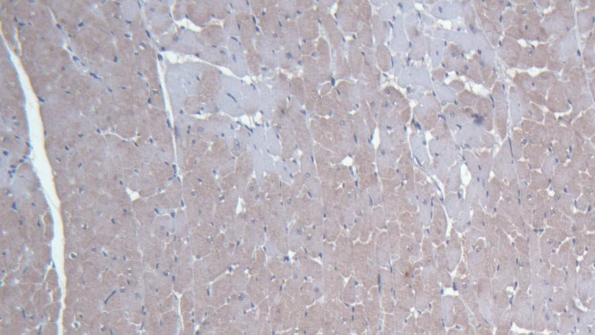 Von Willebrand Factor (vWF) Monoclonal Antibody - image 3