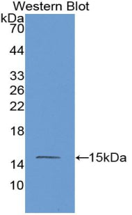 Mannose Associated Serine Protease 2 (MASP2) Monoclonal Antibody - image 2