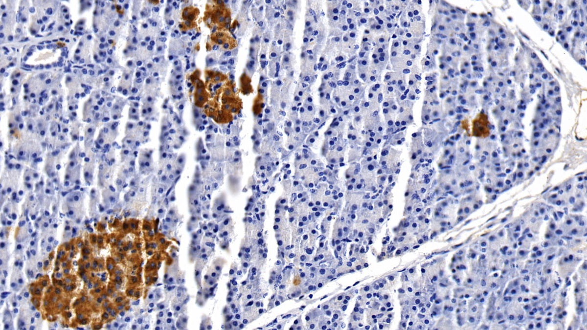Clusterin (CLU) Monoclonal Antibody - image 3