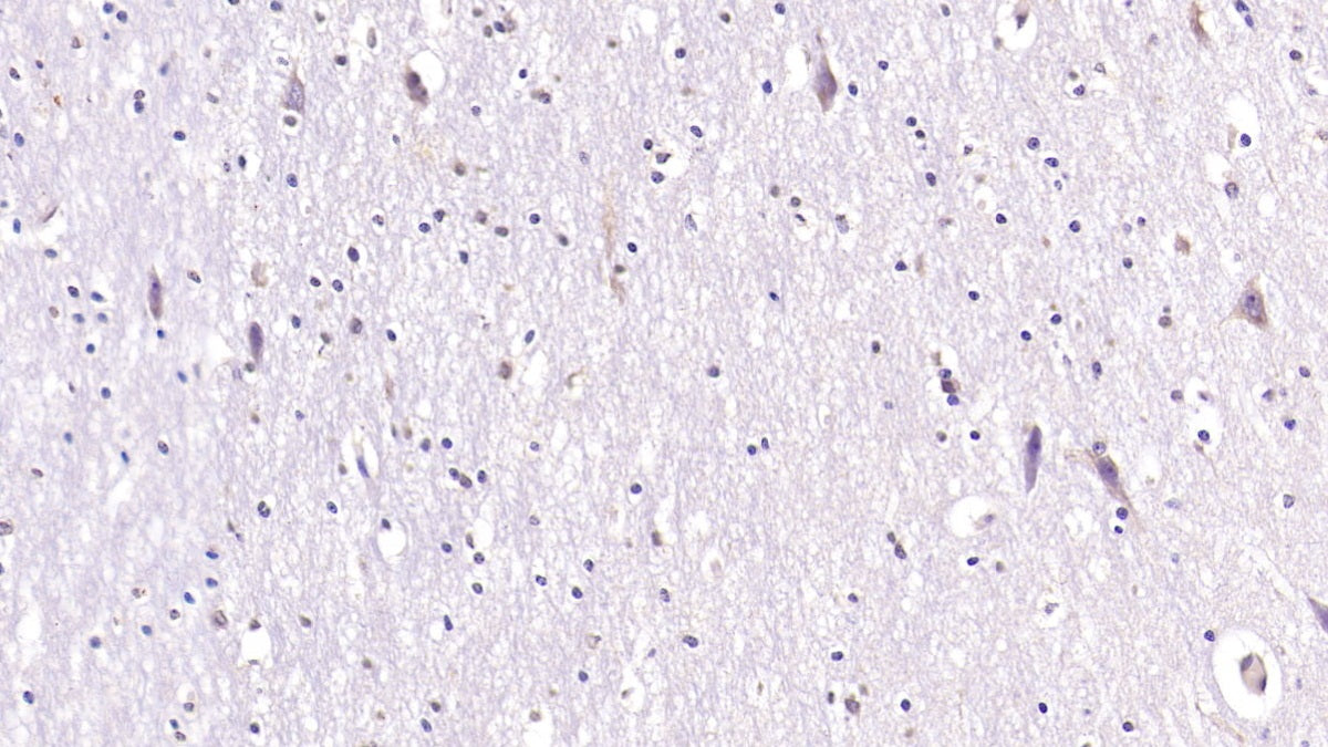DAB staining on IHC-P; Samples: Human Skeletal muscle Tissue;  Primary Ab: 40µg/ml Mouse Anti-Human AchE Antibody Second Ab: 2µg/mL HRP-Linked Caprine Anti-Mouse IgG Polyclonal Antibody