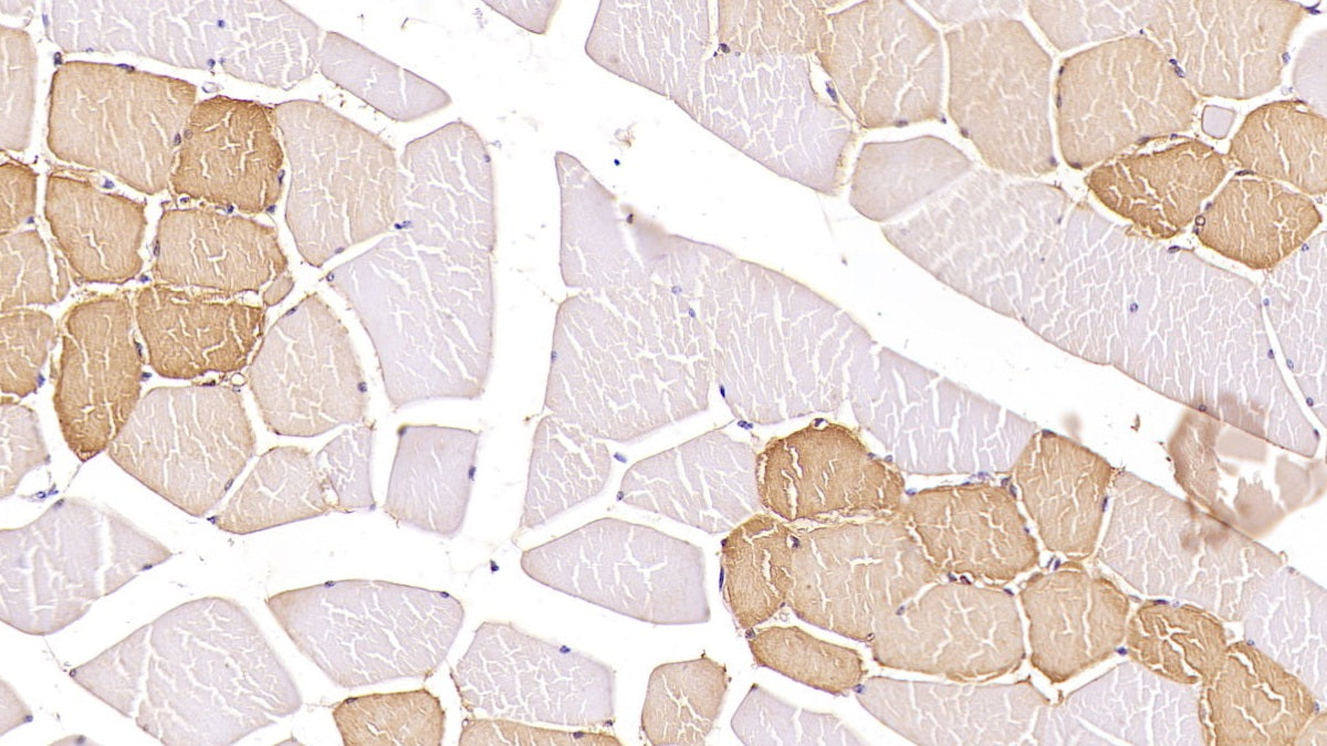 Acetylcholinesterase (ACHE) Monoclonal Antibody - image 4