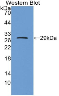 Insulin Like Growth Factor Binding Protein 5 (IGFBP5) Monoclonal Antibody - image 2