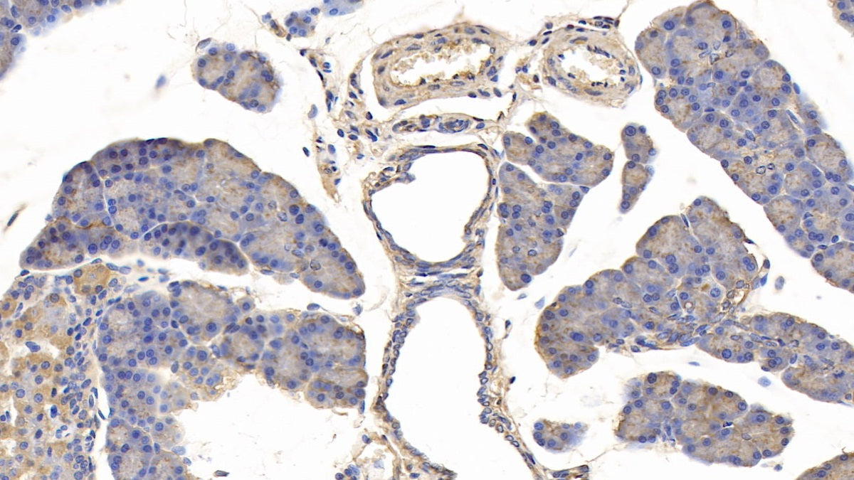 Insulin Like Growth Factor Binding Protein 5 (IGFBP5) Monoclonal Antibody - image 4