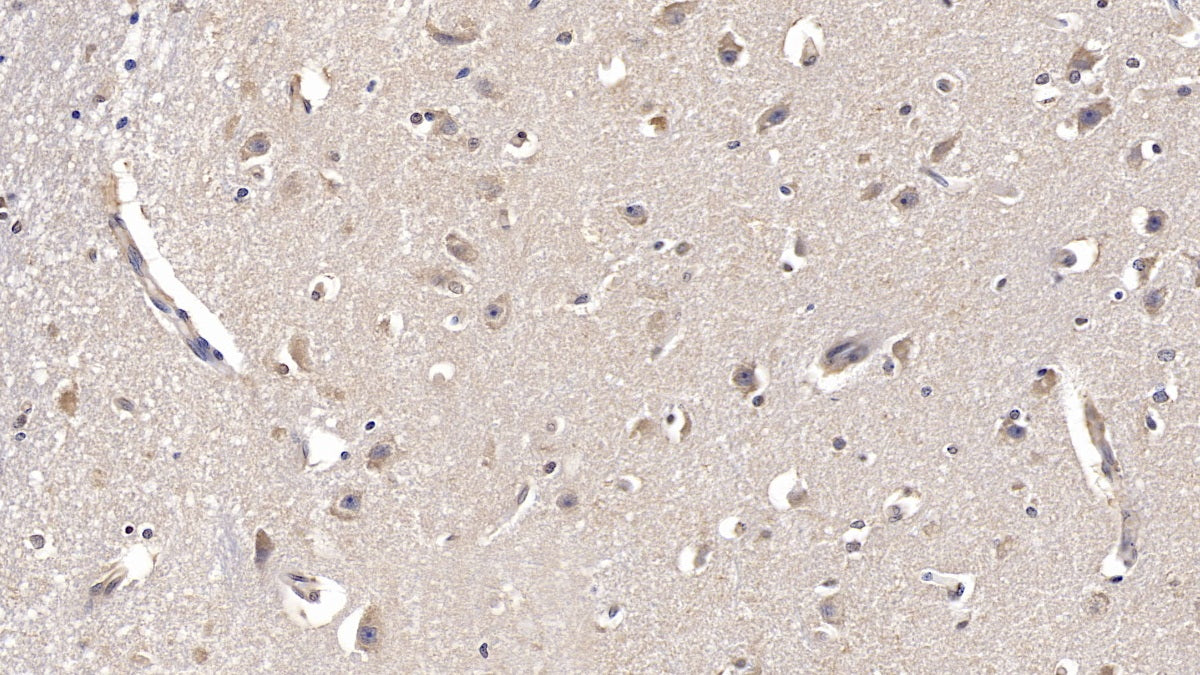 Fibroblast Growth Factor 13 (FGF13) Monoclonal Antibody - image 3