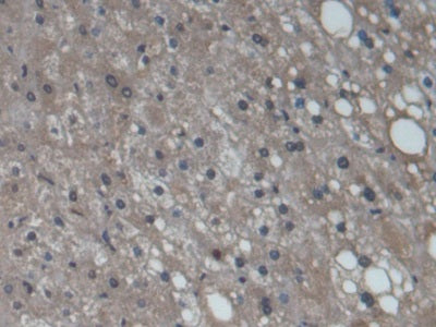 Cytochrome P450 3A7 (CYP3A7) Monoclonal Antibody - image 3