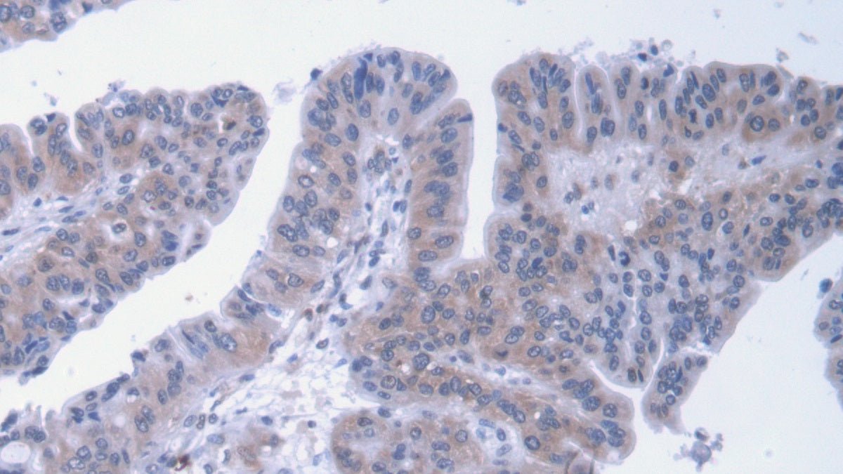 Alpha-2-Macroglobulin (a2M) Monoclonal Antibody - image 2