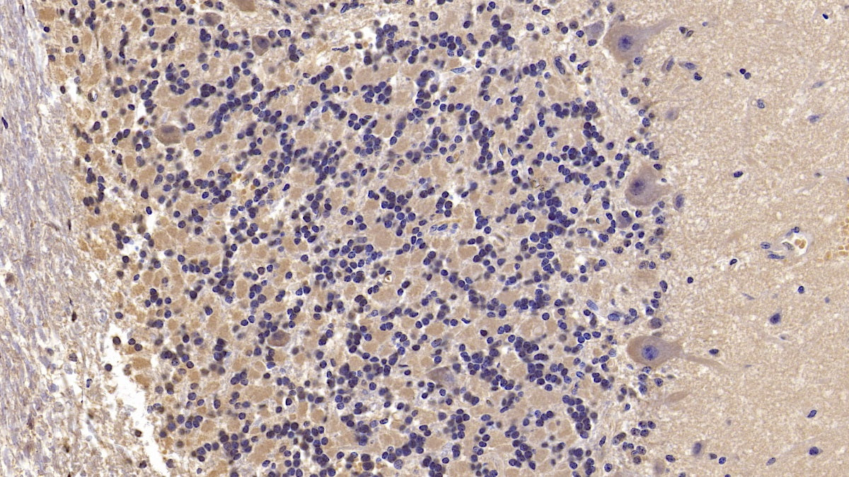 DAB staining on IHC-P; Samples: Human Cardiac Muscle Tissue;  Primary Ab: 10µg/ml Mouse Anti-Human SEMA5B Antibody Second Ab: 2µg/mL HRP-Linked Caprine Anti-Mouse IgG Polyclonal Antibody