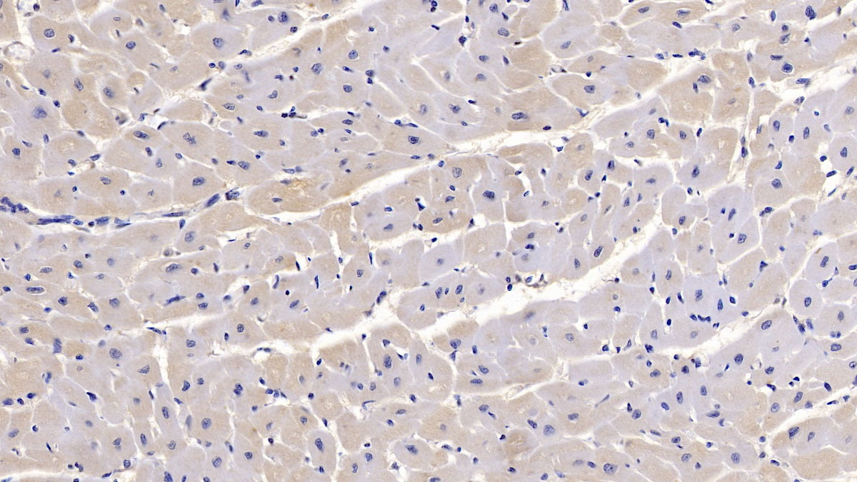 Semaphorin 5B (SEMA5B) Monoclonal Antibody - image 3
