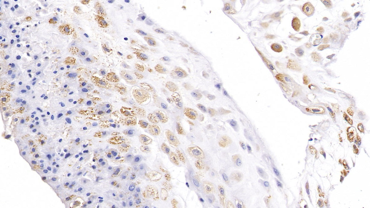 5'-Nucleotidase, Cytosolic II (NT5C2) Polyclonal Antibody - image 2