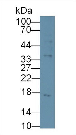 Procalcitonin (PCT) Monoclonal Antibody - image 2