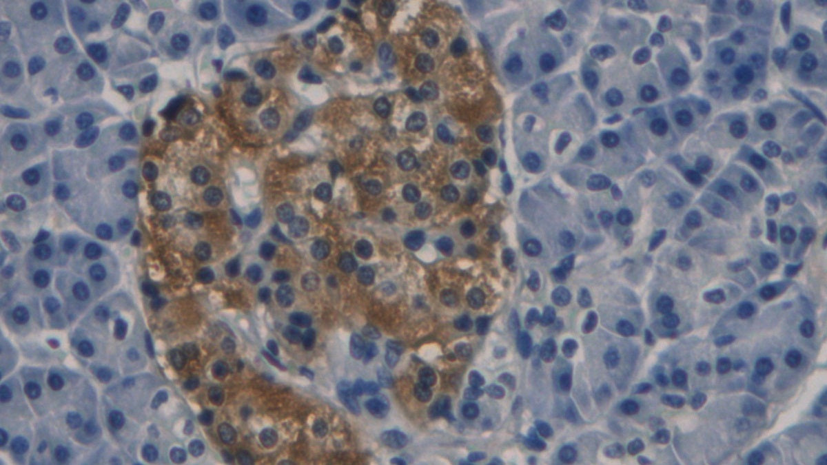 Procalcitonin (PCT) Monoclonal Antibody - image 4