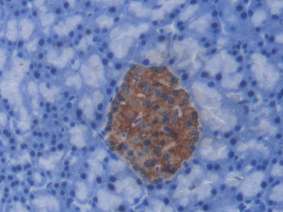 C-Peptide (CP) Monoclonal Antibody - image 2