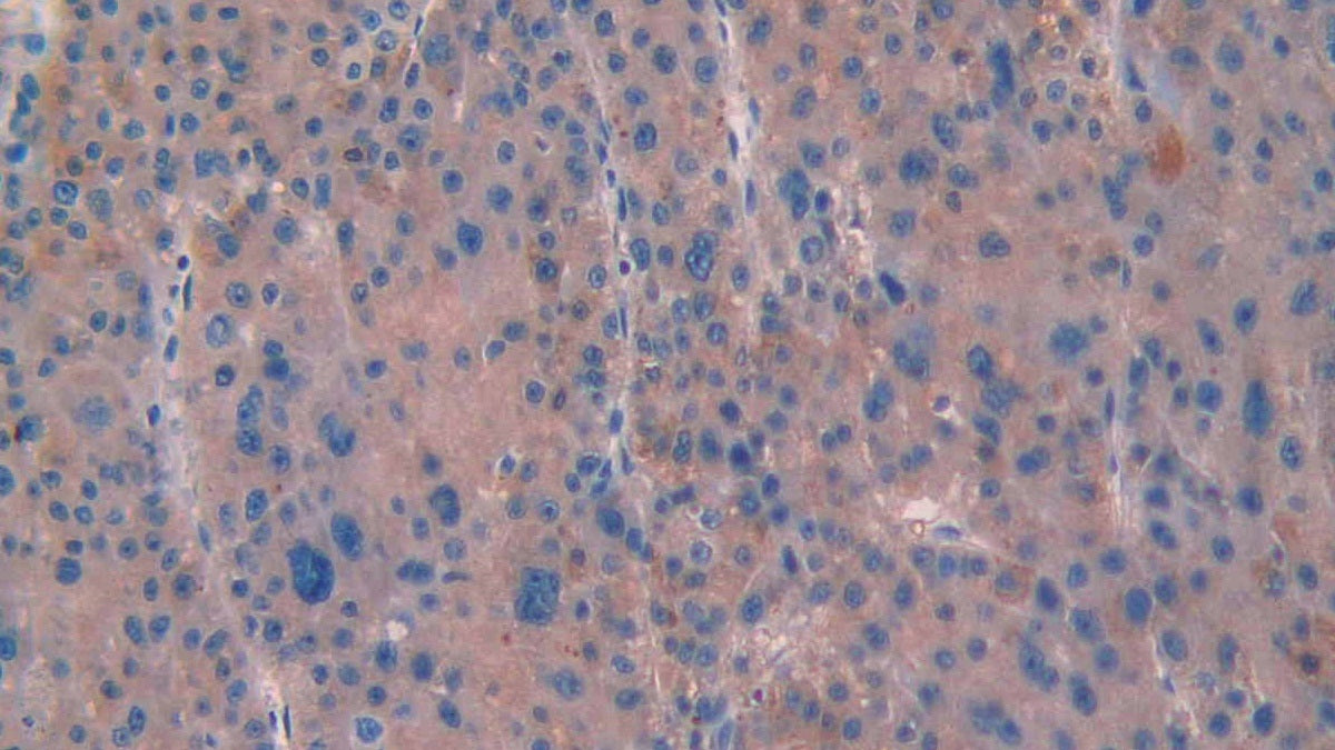 Anti-Mullerian Hormone (AMH) Monoclonal Antibody - image 3