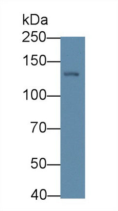 Procollagen III N-Terminal Propeptide (PIIINP) Monoclonal Antibody - image 2