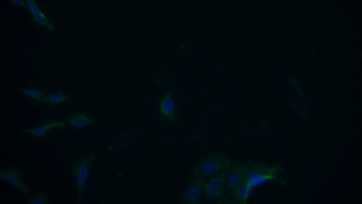Procollagen III N-Terminal Propeptide (PIIINP) Monoclonal Antibody - image 3