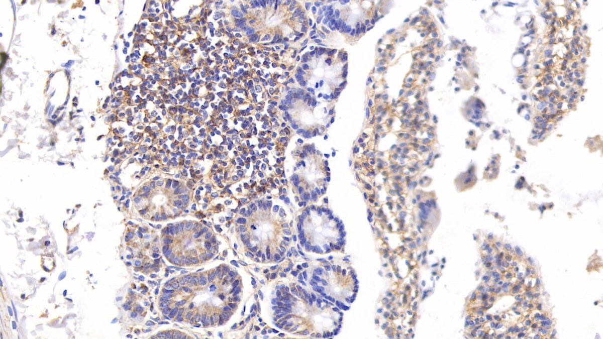 DAB staining on IHC-P; Samples: Rat Liver Tissue; Primary Ab: 10µg/ml Rabbit Anti-Rat VCAM1 Antibody Second Ab: 2µg/mL HRP-Linked Caprine Anti-Rabbit IgG Polyclonal Antibody
