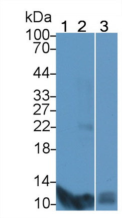 S100 Calcium Binding Protein A7 (S100A7) Polyclonal Antibody - image 2