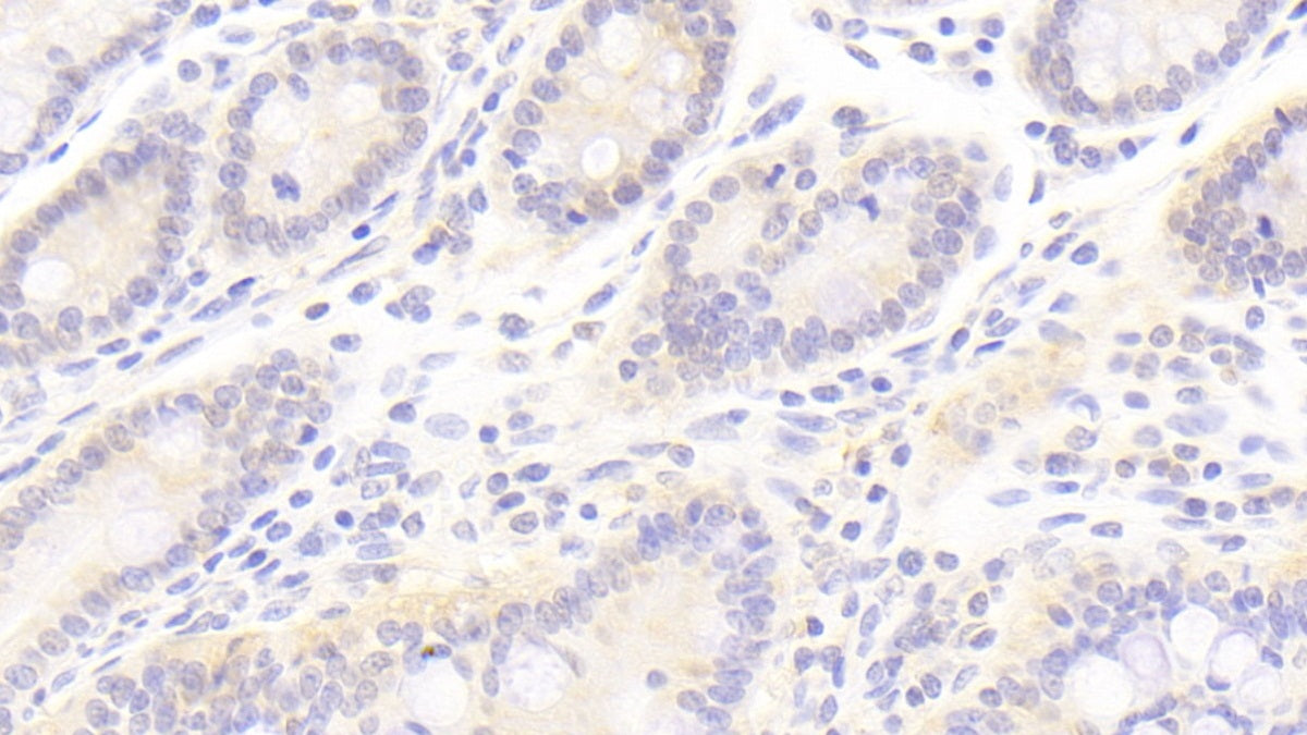 DAB staining on IHC-P; Samples: Human Kidney Tissue;  Primary Ab: 20μg/ml Rabbit Anti-Human ANXA13 Antibody Second Ab: 2µg/mL HRP-Linked Caprine Anti-Rabbit IgG Polyclonal Antibody