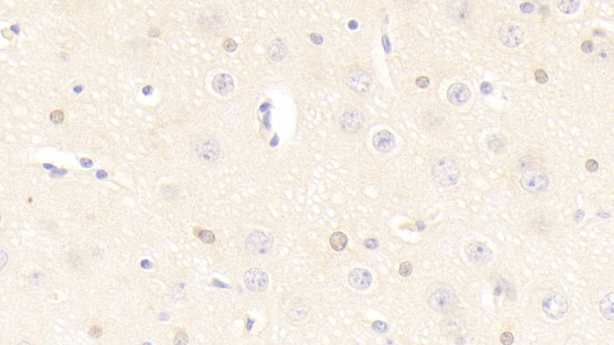DAB staining on IHC-P; Samples: Human Small intestine Tissue;  Primary Ab: 20μg/ml Rabbit Anti-Human FABP2 Antibody Second Ab: 2µg/mL HRP-Linked Caprine Anti-Rabbit IgG Polyclonal Antibody