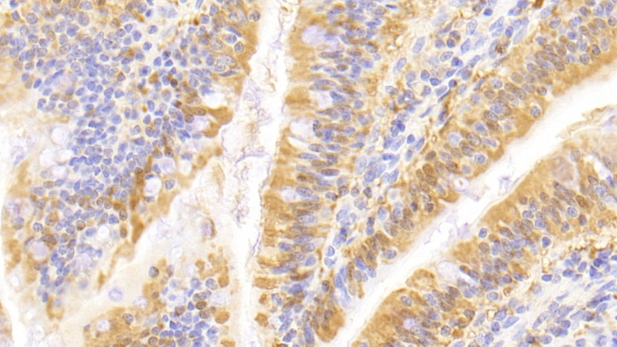 Fatty Acid Binding Protein 2, Intestinal (FABP2) Polyclonal Antibody - image 4