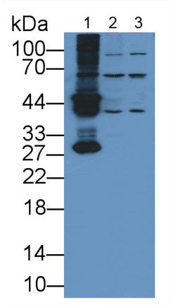 Alanine Glyoxylate Aminotransferase (AGXT) Polyclonal Antibody - image 2