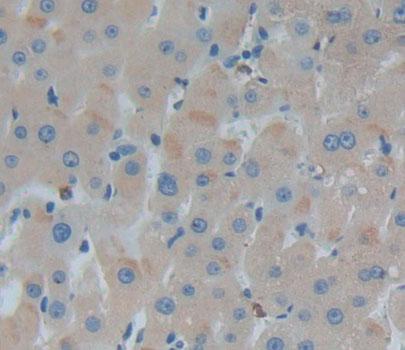 Alanine Glyoxylate Aminotransferase (AGXT) Polyclonal Antibody - image 3
