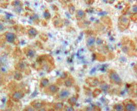 Angiostatin (ANG) Polyclonal Antibody - image 3