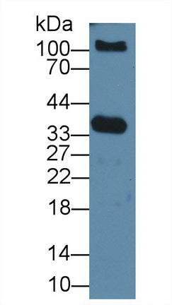 Prostate Specific Antigen (PSA) Polyclonal Antibody - image 2