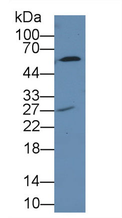 7-Dehydrocholesterol Reductase (DHCR7) Polyclonal Antibody - image 2