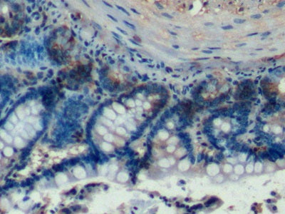 DAB staining on IHC-P; Samples: Rat Small intestine Tissue;  Primary Ab: 10µg/ml Rabbit Anti-Rat HCA