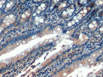 Homing Associated Cell Adhesion Molecule (HCAM) Polyclonal Antibody - image 4