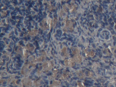 DAB staining on IHC-P; Samples: Rabbit Stomach Tissue; Primary Ab: 20µg/ml Cavia Anti-Rabbit a2M Antibody Second Ab: 2µg/mL HRP-Linked Rabbit Anti-Cavia IgG Polyclonal Antibody