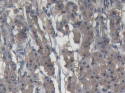 Alpha-2-Macroglobulin (a2M) Polyclonal Antibody - image 3