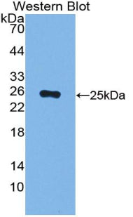 Alpha-1-Acid Glycoprotein (a1AGP) Polyclonal Antibody - image 2