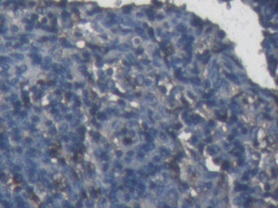 DAB staining on IHC-P; Samples: Rabbit Liver Tissue;  Primary Ab: 20µg/ml Cavia Anti-Rabbit a1AGP An